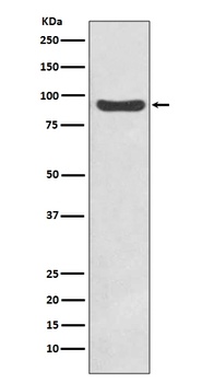 IKK beta IKBKB Rabbit Monoclonal Antibody