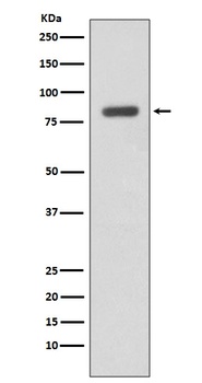 IKK beta IKBKB Rabbit Monoclonal Antibody