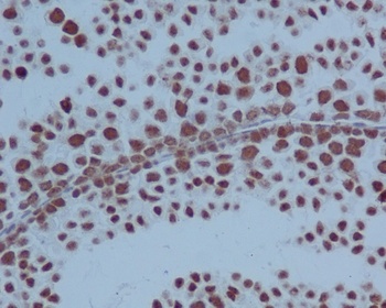 Anti-PARP PARP1 Rabbit Monoclonal Antibody