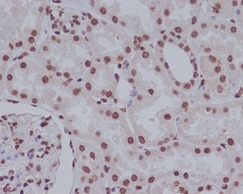 Anti-Cleaved PARP PARP1 Rabbit Monoclonal Antibody