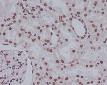 Cleaved PARP PARP1 Rabbit Monoclonal Antibody