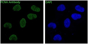 Anti-PCNA Rabbit Monoclonal Antibody