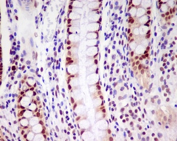 Anti-PCNA Rabbit Monoclonal Antibody