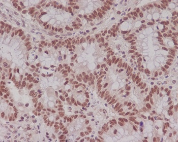 MLH1 Rabbit Monoclonal Antibody