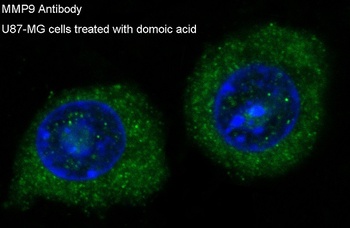 Anti-MMP9 Rabbit Monoclonal Antibody
