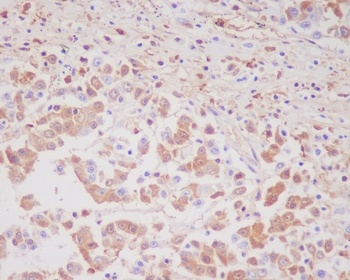 MMP9 Rabbit Monoclonal Antibody