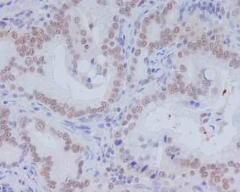 CD11b ITGAM Rabbit Monoclonal Antibody