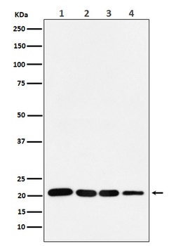 p21 CDKN1A Rabbit Monoclonal Antibody