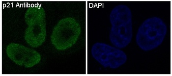 p21 CDKN1A Rabbit Monoclonal Antibody