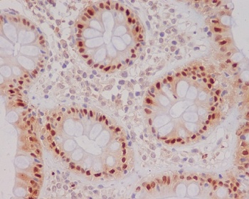 p21 CDKN1A Rabbit Monoclonal Antibody