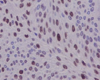 Anti-Cyclin D1 CCND1 Rabbit Monoclonal Antibody
