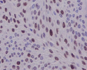 Cyclin D1 CCND1 Rabbit Monoclonal Antibody