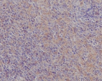 Anti-FAK PTK2 Rabbit Monoclonal Antibody