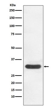 CDK4 Rabbit Monoclonal Antibody