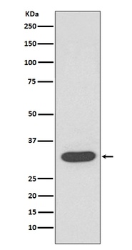 CDK4 Rabbit Monoclonal Antibody