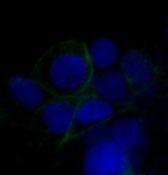 GLUT1 SLC2A1 Rabbit Monoclonal Antibody