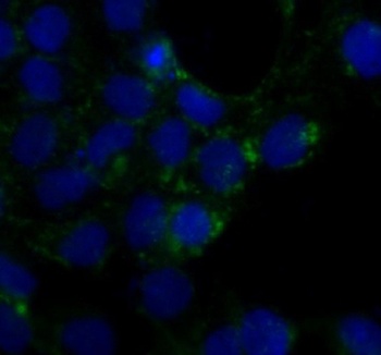 Caveolin-1 CAV1 Rabbit Monoclonal Antibody