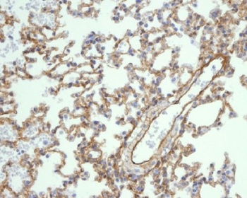 Caveolin-1 CAV1 Rabbit Monoclonal Antibody