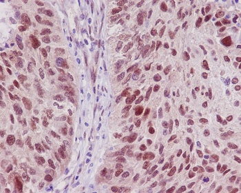 TRAF6 Rabbit Monoclonal Antibody