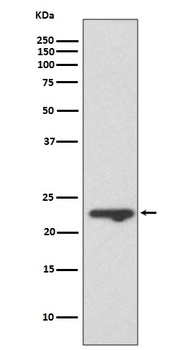 MUC1 Rabbit Monoclonal Antibody