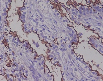 MUC1 Rabbit Monoclonal Antibody