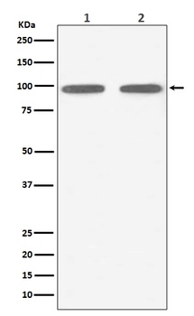 FGFR3 Rabbit Monoclonal Antibody
