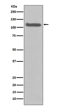 FGFR3 Rabbit Monoclonal Antibody