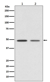 Vitamin D Receptor VDR Rabbit Monoclonal Antibody