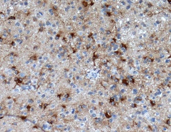 Anti-GFAP Rabbit Monoclonal Antibody