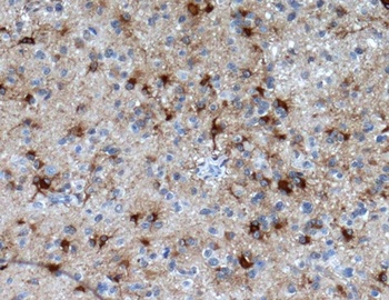 GFAP Rabbit Monoclonal Antibody