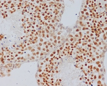 Alpha Synuclein SNCA Rabbit Monoclonal Antibody