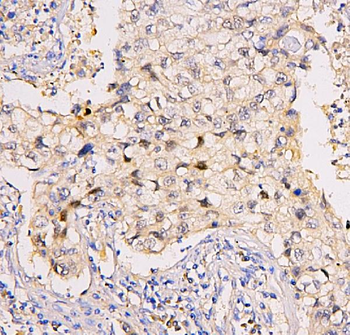 Anti-BRG1 SMARCA4 Antibody (monoclonal, 3F4)