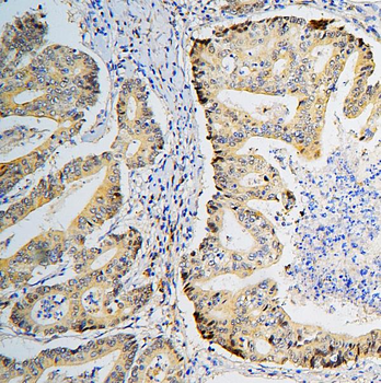 Anti-BRG1 SMARCA4 Antibody (monoclonal, 3F4)