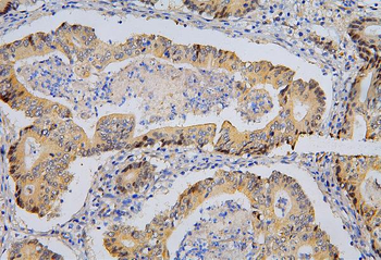 Anti-BRG1 SMARCA4 Antibody (monoclonal, 3F4)
