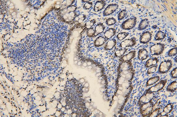 Anti-BRG1 SMARCA4 Antibody (monoclonal, 3F4)