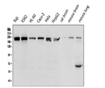 Anti-BRG1 SMARCA4 Antibody (monoclonal, 3F4)