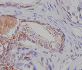 Tuberin TSC2 Rabbit Monoclonal Antibody