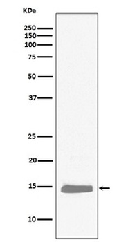Hemoglobin subunit alpha HBA1 Rabbit Monoclonal Antibody