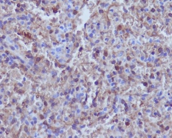 Anti-Hemoglobin subunit alpha HBA1 Rabbit Monoclonal Antibody