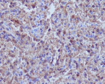 Hemoglobin subunit alpha HBA1 Rabbit Monoclonal Antibody