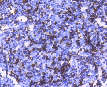 Hemoglobin subunit alpha HBA1 Rabbit Monoclonal Antibody