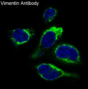 Vimentin Rabbit Monoclonal Antibody