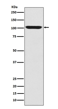 LGR5/GPR49 Rabbit Monoclonal Antibody