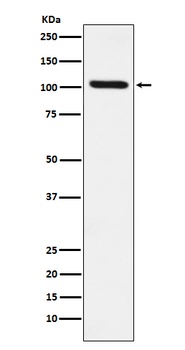 DDX58 Rabbit Monoclonal Antibody