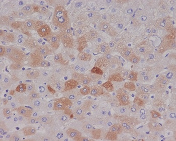 C Reactive Protein CRP Rabbit Monoclonal Antibody