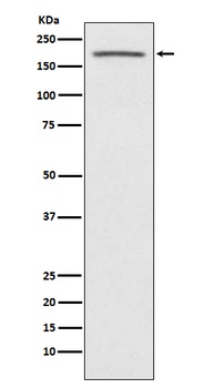ACE1 Rabbit Monoclonal Antibody