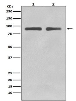 FoxO3a Rabbit Monoclonal Antibody