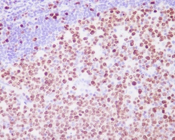 Anti-Ki67 MKI67 Rabbit Monoclonal Antibody