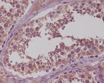 Anti-NAK/TBK1 (N-term) Rabbit Monoclonal Antibody