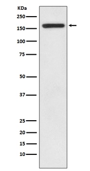 IRS1 Rabbit Monoclonal Antibody